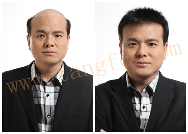 李開復(fù)患淋巴癌，現(xiàn)代人透支健康、過早脫發(fā)引人深思