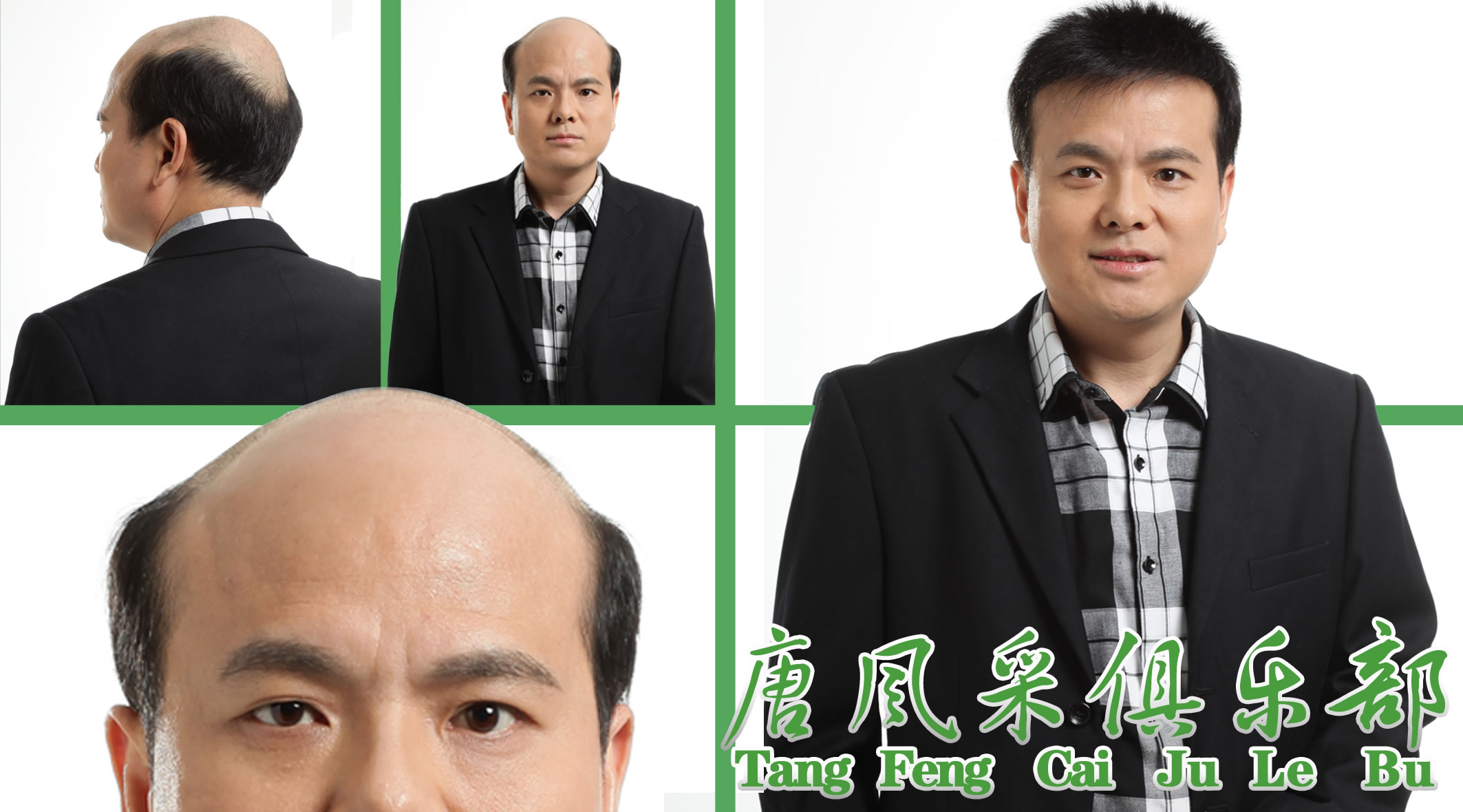 假發(fā)、跟織發(fā)有什么區(qū)別