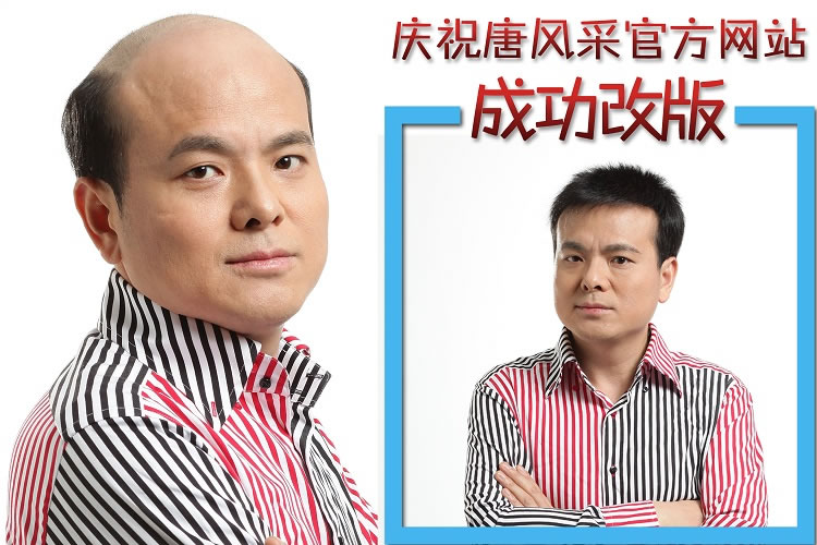 女生不脫發(fā)可以做增發(fā)么？