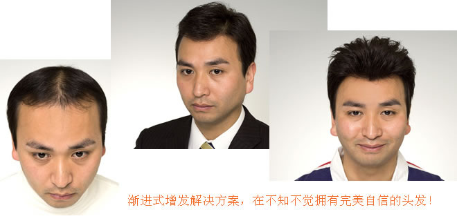 怎么洗頭才不容易脫發(fā)？