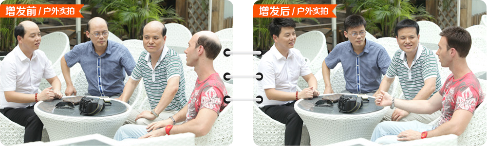 黑發(fā)變白怎么辦？
