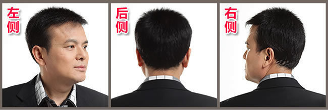 前額兩邊頭發(fā)稀疏怎么辦？看了你就知道怎么解決！