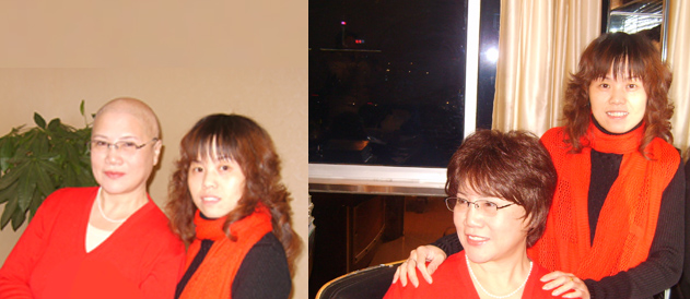 女性頭發(fā)稀疏謝頂怎么辦？如果發(fā)體稀疏就要避免這些！