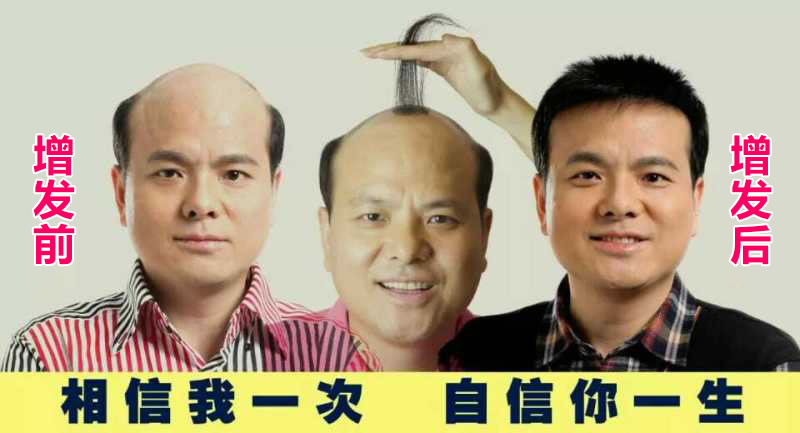補頭發(fā) 補頭發(fā)的食物有哪些 電子時代如何防脫發(fā)