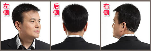 頭發(fā)再生技術(shù) 頭發(fā)再生技術(shù)怎么樣 再生發(fā)體是怎么操作的