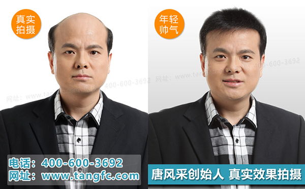 禿頂補發(fā)就選唐風(fēng)采補發(fā)機構(gòu) 禿頂補發(fā)就選唐風(fēng)采補發(fā)機構(gòu)
