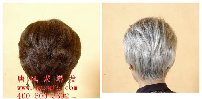 有了白發(fā)怎么辦？怎么讓白發(fā)變黑發(fā)？
