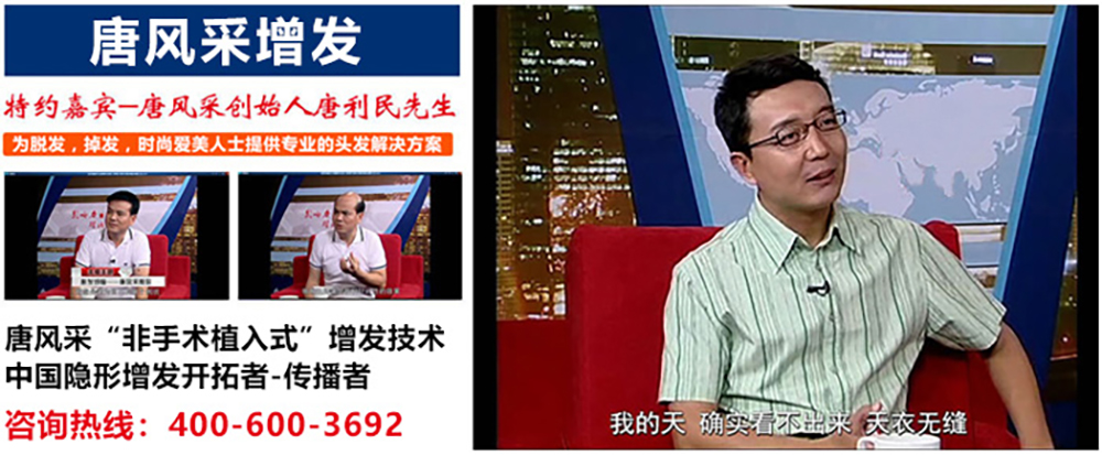 禿頂怎么辦,有辦法了 \