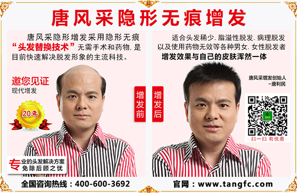 禿頂植發(fā)要多少錢？脫發(fā)禿頂又與頭皮屑有什么關(guān)聯(lián)？