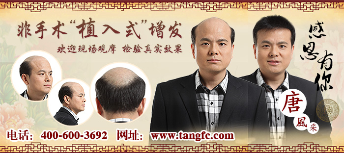 2015織發(fā)哪個(gè)牌子好？