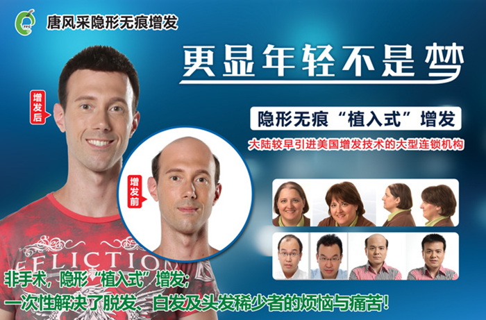 斑禿不要怕，小編帶您見證唐風(fēng)采效果！