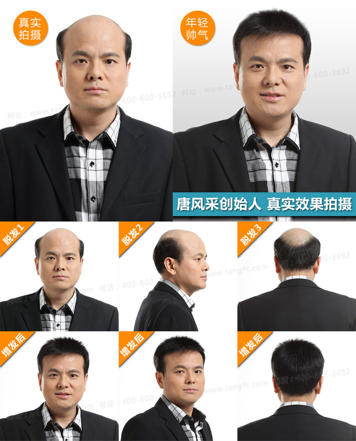 禿頂了，品牌假發(fā)定做為你保駕護(hù)航