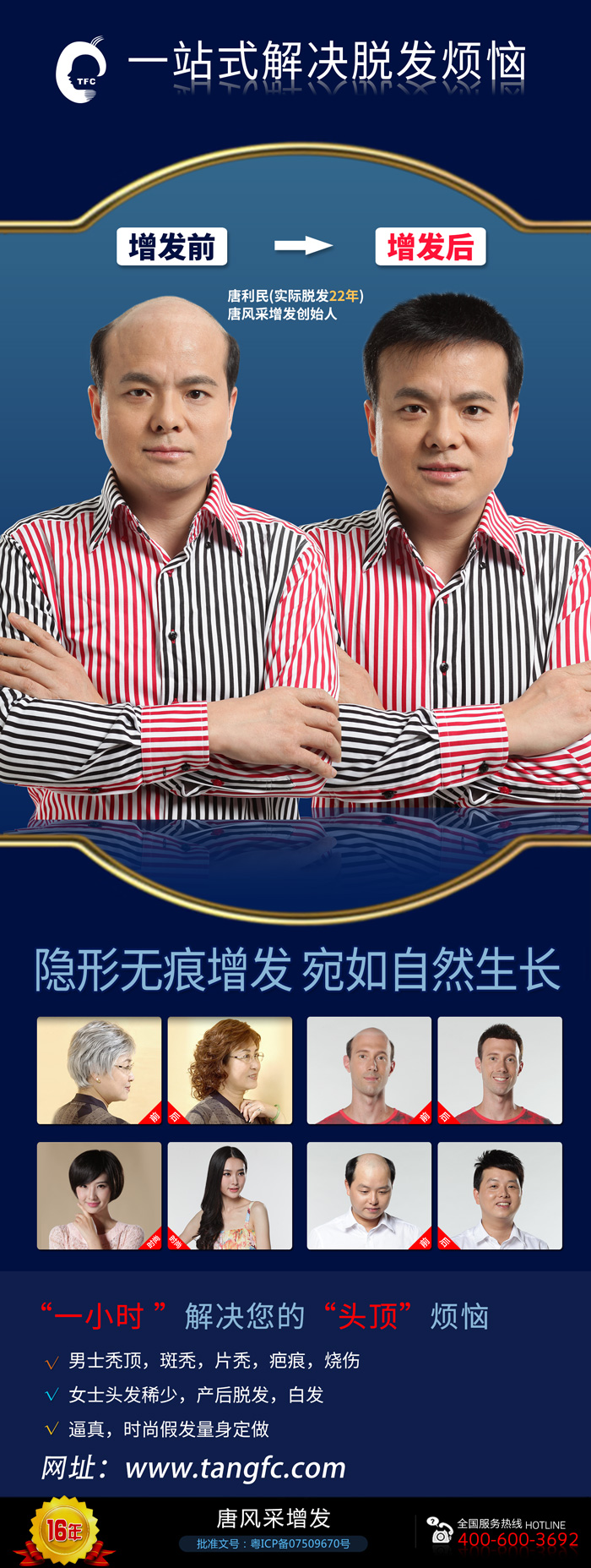 無痕補(bǔ)發(fā)價格是多少？哪里補(bǔ)發(fā)技術(shù)比較好？