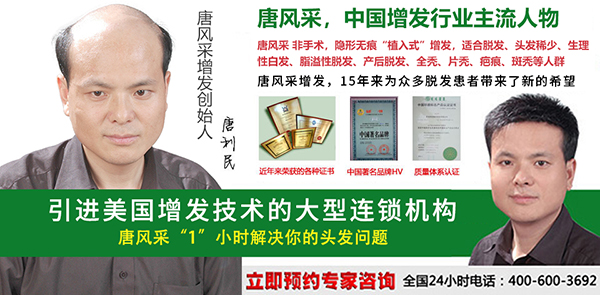 早禿怎么辦？哪里能進(jìn)行男士頭發(fā)加密？