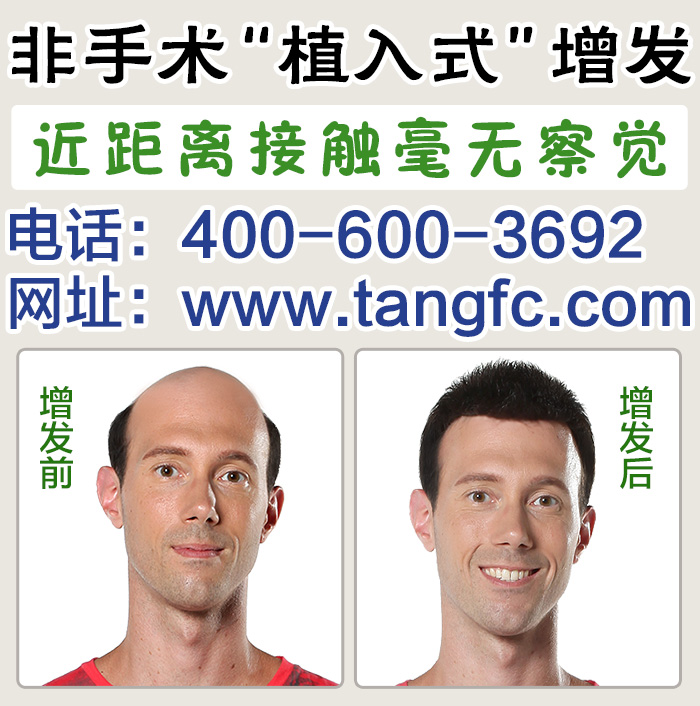 脫發(fā)怎么辦？品牌假發(fā)定做技術(shù)成熟嗎？