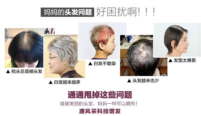 日常習(xí)慣要注意，防火防盜防白發(fā)脫發(fā)！
