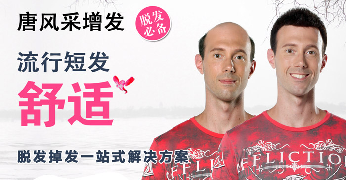 補頭發(fā)的食物 補頭發(fā)的食物有哪些 如何改善嚴重脫發(fā)
