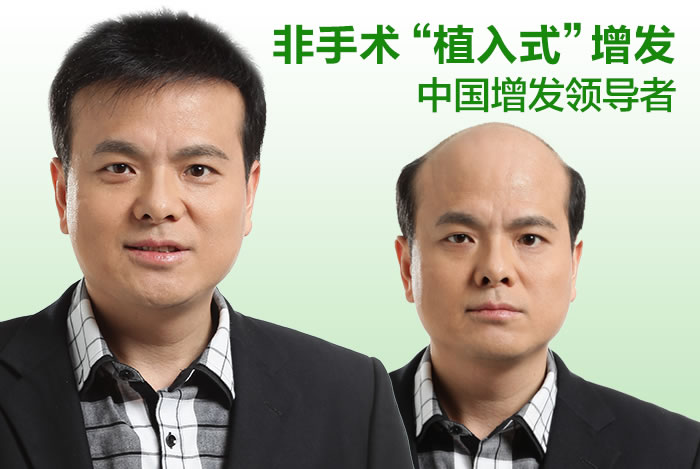 頭發(fā)稀少用什么？預防與解決需要懂這些