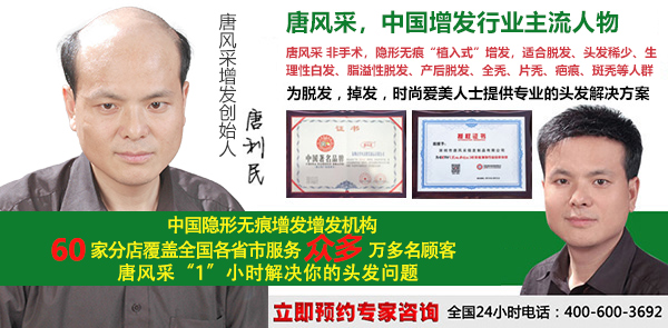 大連自然織發(fā)找哪家好？脫發(fā)復原就靠這個了！