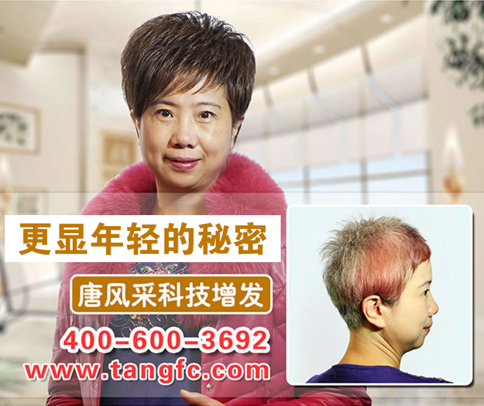 南寧最好的織發(fā)店在哪？脫發(fā)用織發(fā)可以救嗎？