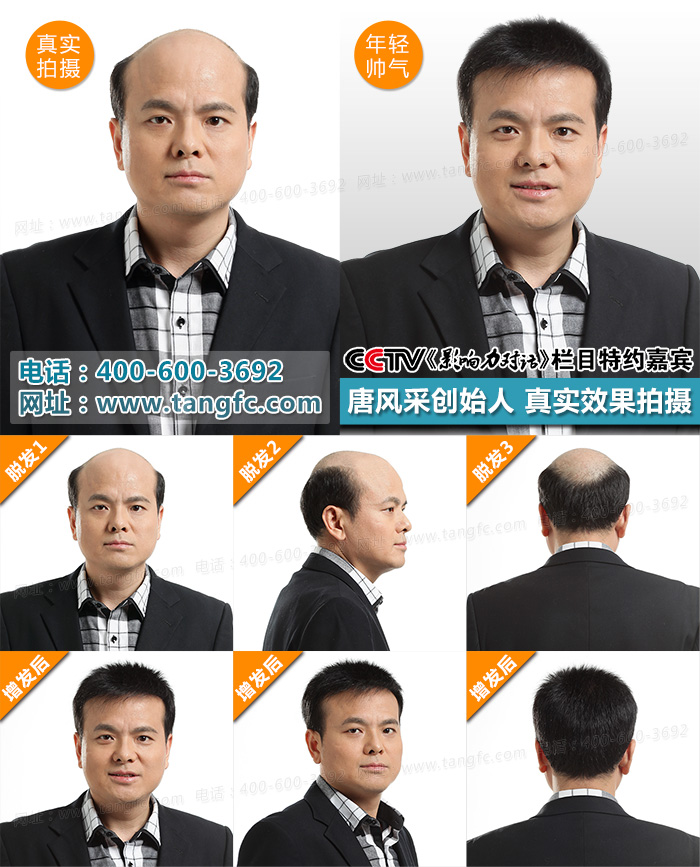 根據(jù)男士假發(fā)對(duì)比效果，哪個(gè)品牌假發(fā)值得信賴