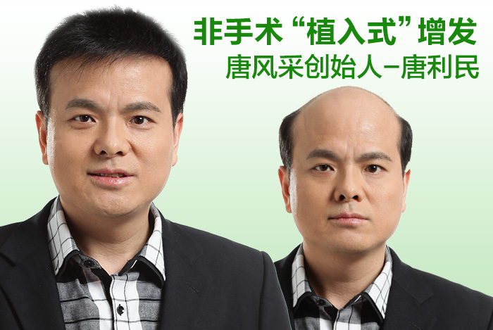 唐風(fēng)采補(bǔ)發(fā)合肥店怎么樣？隱形無痕的效果是真實(shí)的嗎？