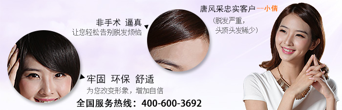 西安高檔假發(fā) 西安高檔假發(fā)個(gè)性設(shè)計(jì),讓脫發(fā)也能擁有時(shí)尚發(fā)型
