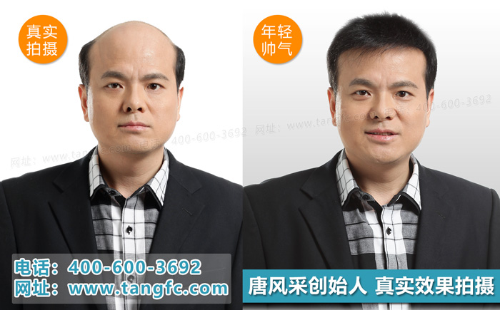 廈門賣假發(fā) 廈門哪里有賣假發(fā)的 售后問題事關(guān)緊要