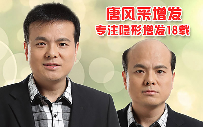 男士發(fā)型 哪種男士發(fā)型好看?掉頭發(fā)怎么辦