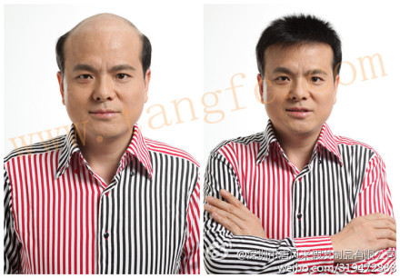 如何選擇男士假發(fā)專賣店？這類人易得雄脫