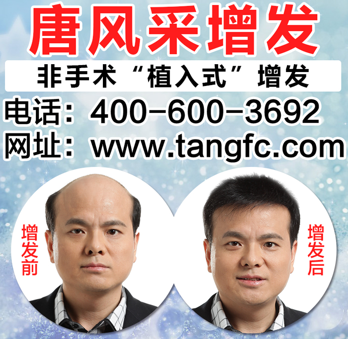 男士假發(fā)定做 真人發(fā)男士假發(fā)定做 油性頭發(fā)怎么改善