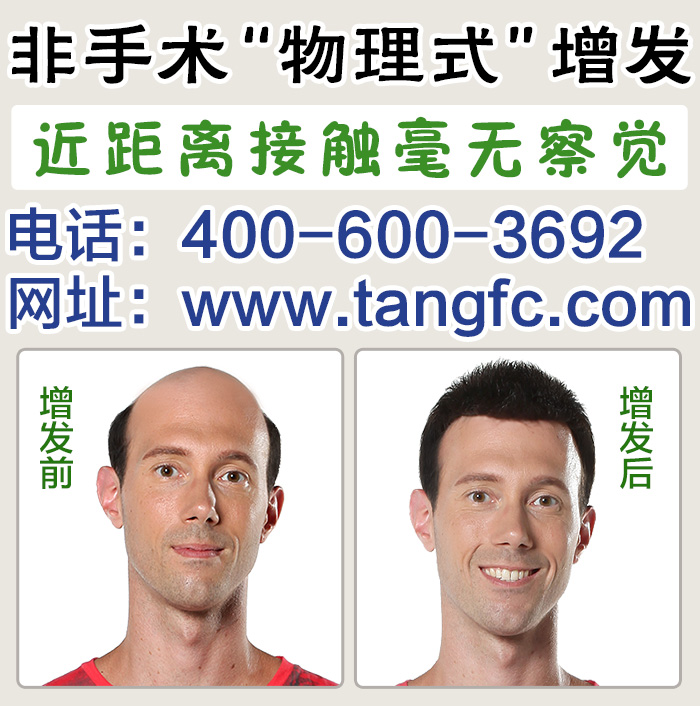 游戲男別為頭發(fā)困擾，唐風采上海補發(fā)機構為您解決問題！