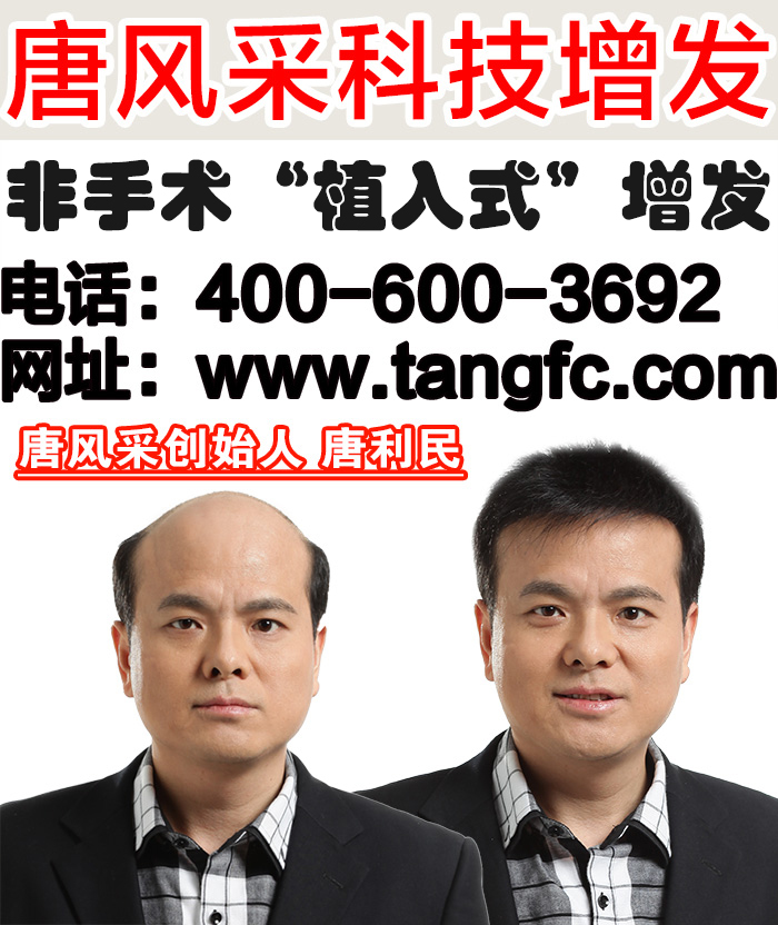 真人發(fā)中年男士假發(fā)多少錢？中年人為何易禿