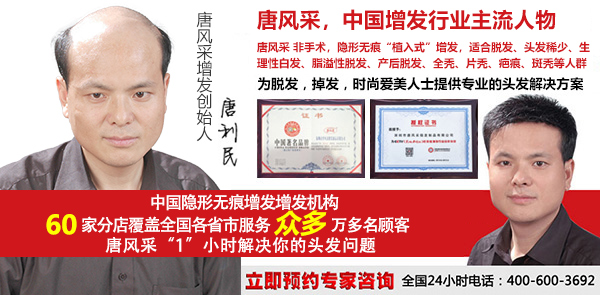 傳統(tǒng)男士假發(fā)套和補發(fā)的區(qū)別，長期戴哪種更好？
