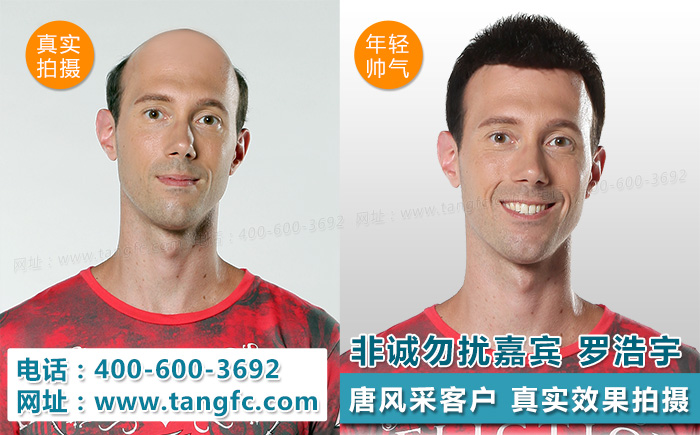明星很逼真的假發(fā)，渾然天成的感覺是怎么做到的？