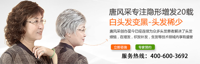 柳州買隱形假發(fā)哪家好？唐風(fēng)采的高超技術(shù)征服了我
