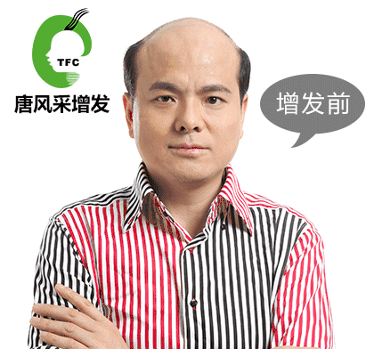 脫發(fā)頻繁 脫發(fā)頻繁容易抑郁 白領過勞現(xiàn)象叢生
