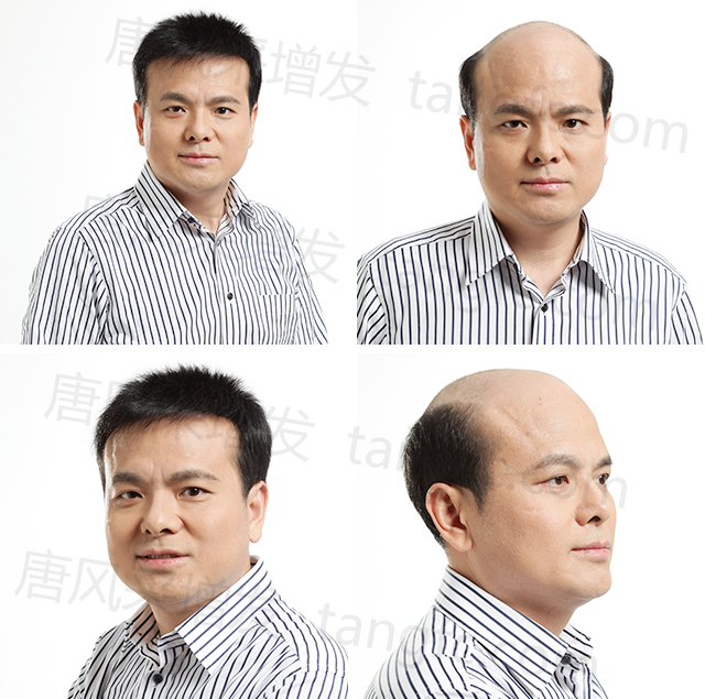 佛山買隱形假發(fā)哪家好？要讓人看不出是戴著假發(fā)