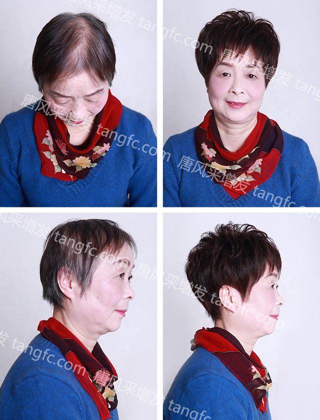 拉薩買隱形假發(fā)哪家好？唐風(fēng)采增發(fā)技術(shù)好！