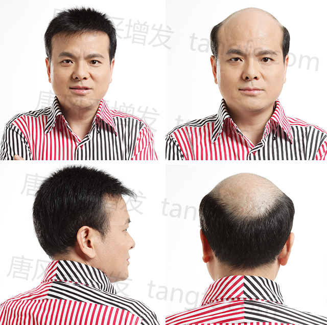 男士假發(fā)受歡迎，假發(fā)并不只是女人的專利!