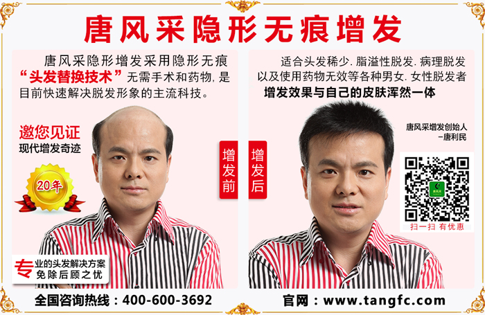 嘉興織發(fā)補(bǔ)發(fā)哪里最好？唐風(fēng)采不會(huì)讓你失望！