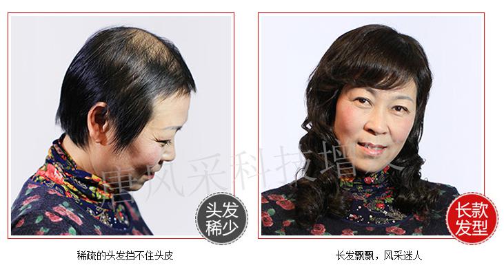 嘉興織發(fā)補(bǔ)發(fā)中心，唐風(fēng)采專業(yè)補(bǔ)發(fā)塑造完美形象