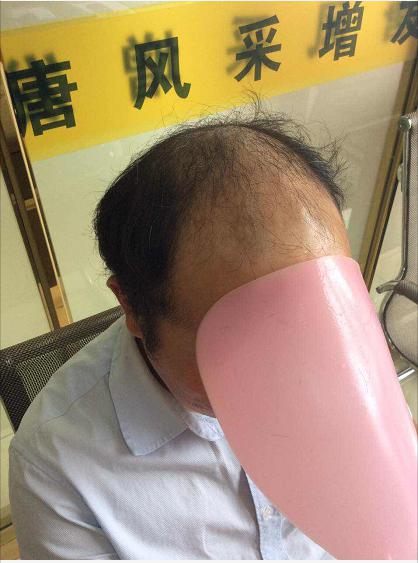 沒有對比就沒有傷害，唐風(fēng)采增發(fā)品質(zhì)看得見！