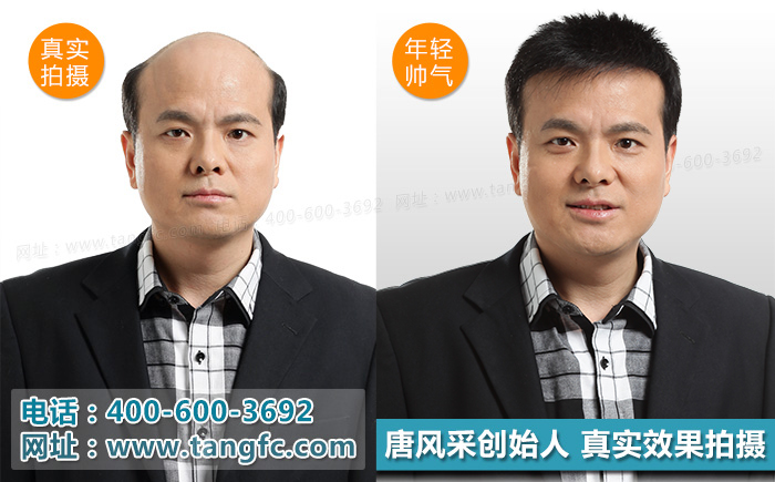 奧尼爾戴白發(fā)開懟，小伙伴們千萬別模仿！