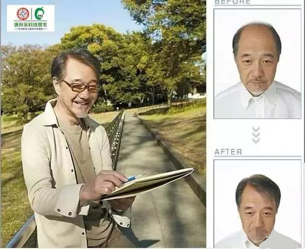 來自NASA的黑科技生發(fā)頭盔，禿頂有救了？