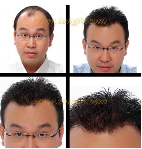 哪家假發(fā)適合脫發(fā)人？金華哪里有假發(fā)專賣店？