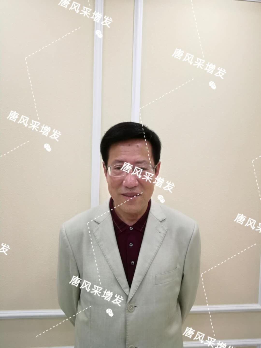 脫發(fā)禿頂成中年男人標(biāo)配？唐風(fēng)采增發(fā)讓您風(fēng)采始終如一