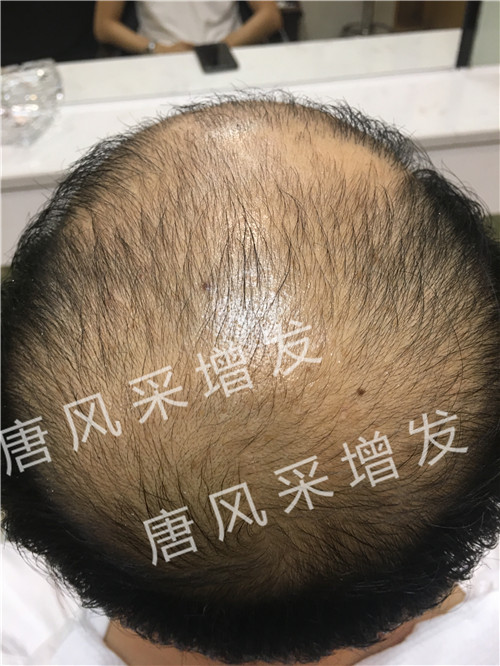 今天咱不看廣告宣傳了，唐風采真實效果，上圖上視頻