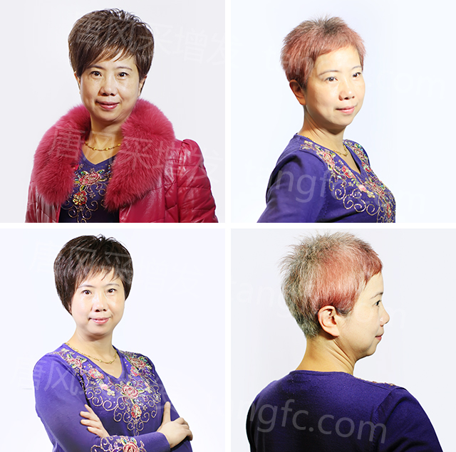 柳州織發(fā)假發(fā)訂做，效果杠杠不負(fù)好時光！