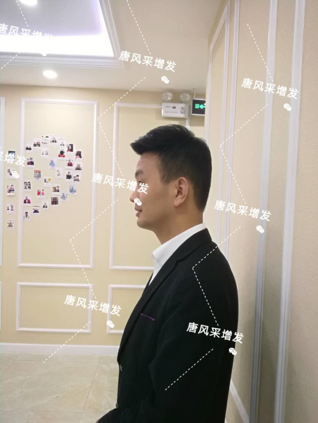 輸了頭發(fā)不能輸氣質，看帥哥的逆襲之路！